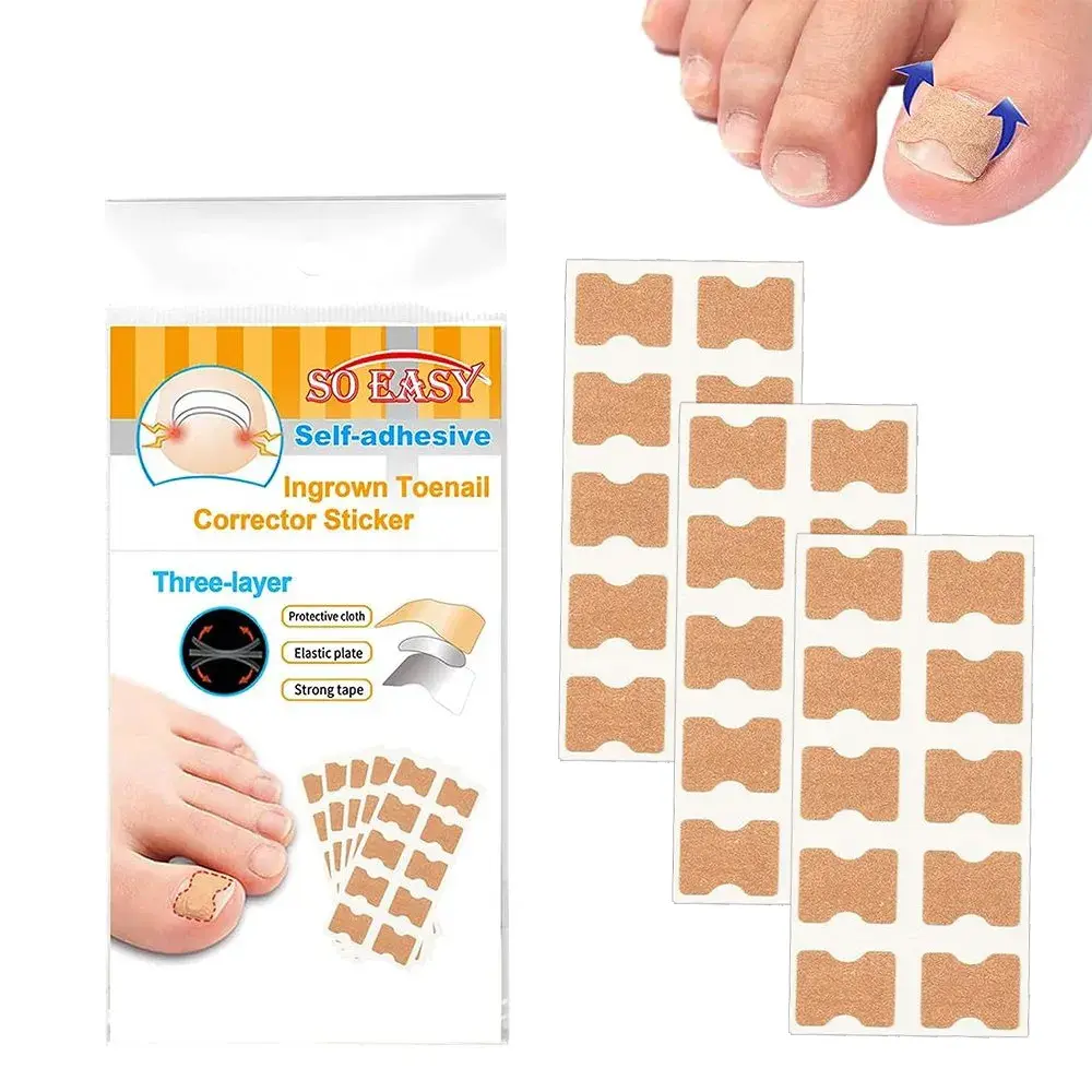 Пластырь для корректировки вросших ногтей, 50 штук, цвет бежевый, водостойкий
